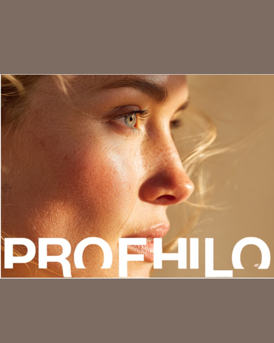 Profhilo: The Injectable Glow Treatment Everyone's Talking About